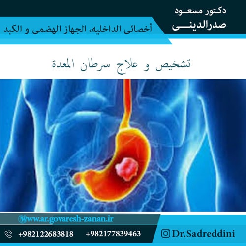 تشخيص و علاج سرطان المعدة