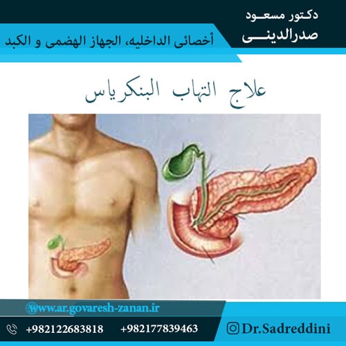 علاج التهاب البنكرياس