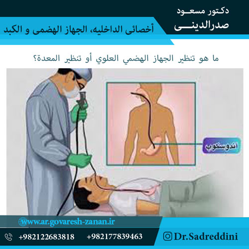 ما هو تنظير الجهاز الهضمي العلوي أو تنظير المعدة؟