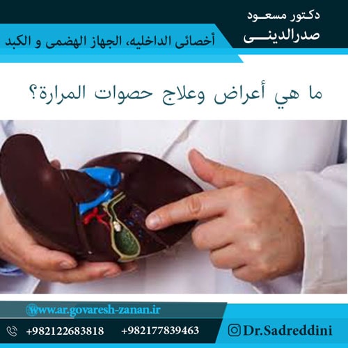 ما هي أعراض وعلاج حصوات المرارة؟