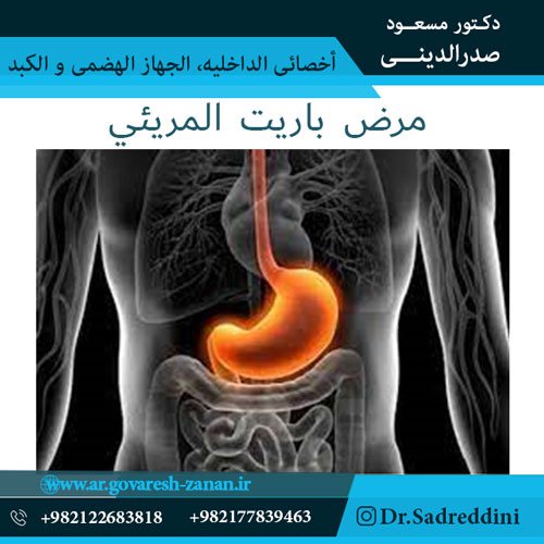 مرض باريت المريئي بسبب الارتجاع المعدي المريئي (المريء)